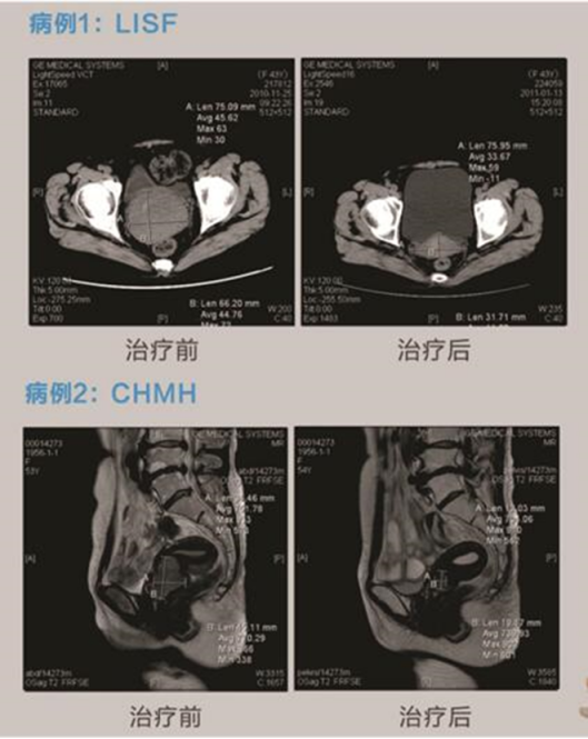 WeChat Image_20200606132319.png