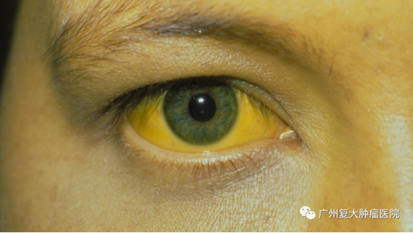 WeChat Image_20210322172155.png