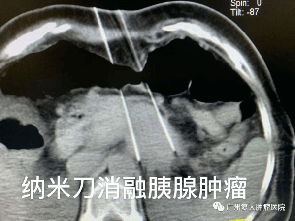 WeChat Image_20210803105717.png