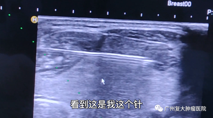 WeChat Image_20220325163240.png