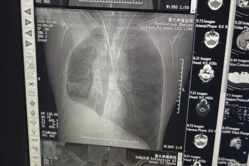 Image_20250603154404.png