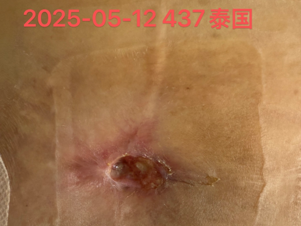 Image_20250605162138.png