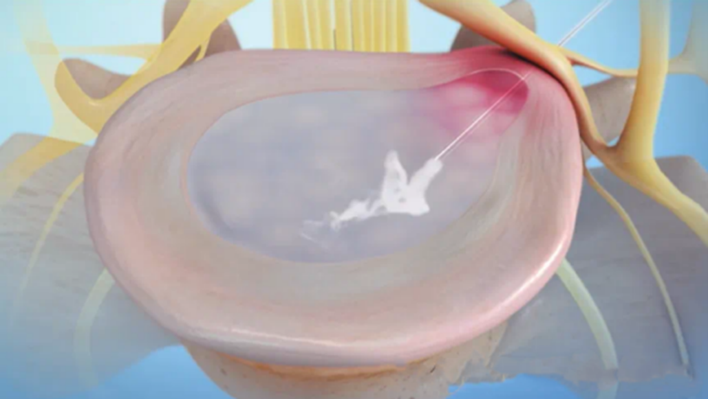 fuda09_420323.png fuda09_420323.png